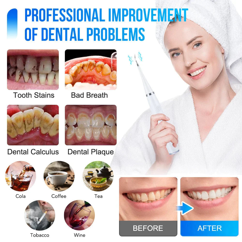 Ultrasonic Cleaner for a Bright Smile - Souliia