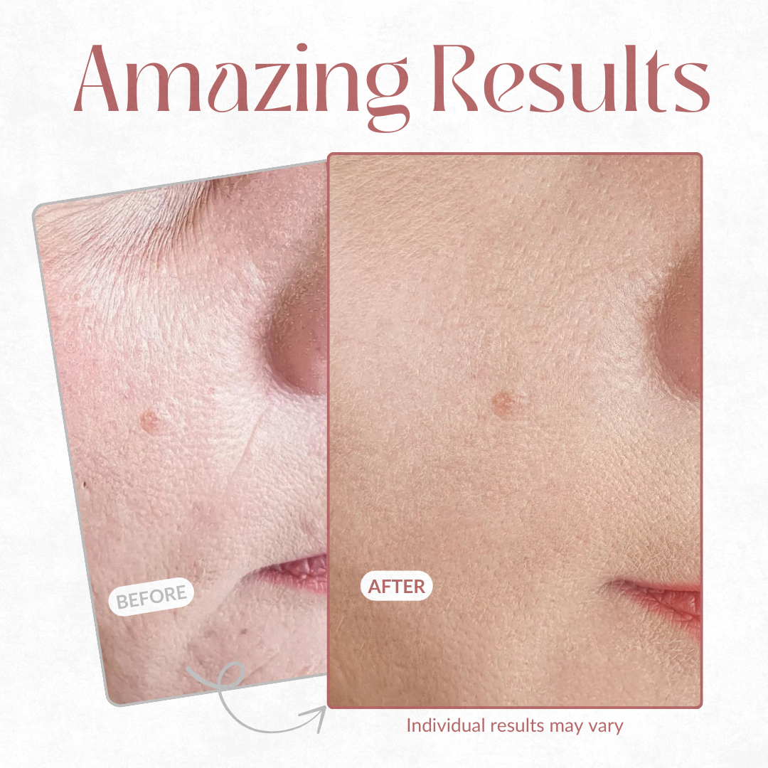 RadiantLift — Unleash Youthful Skin That Commands Every Glance - Souliia