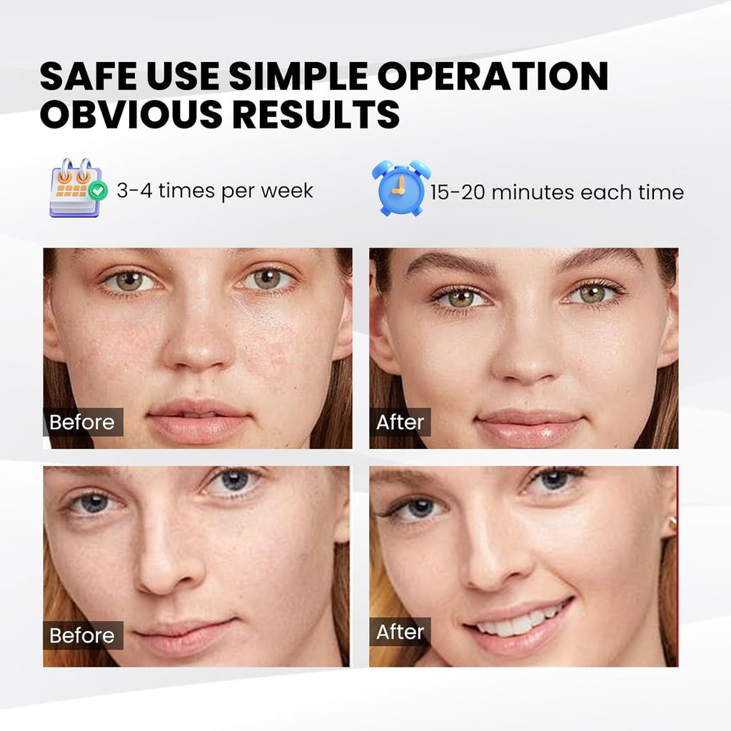 7-Color LED Red Light Facial Therapy Mask — Customizable Care