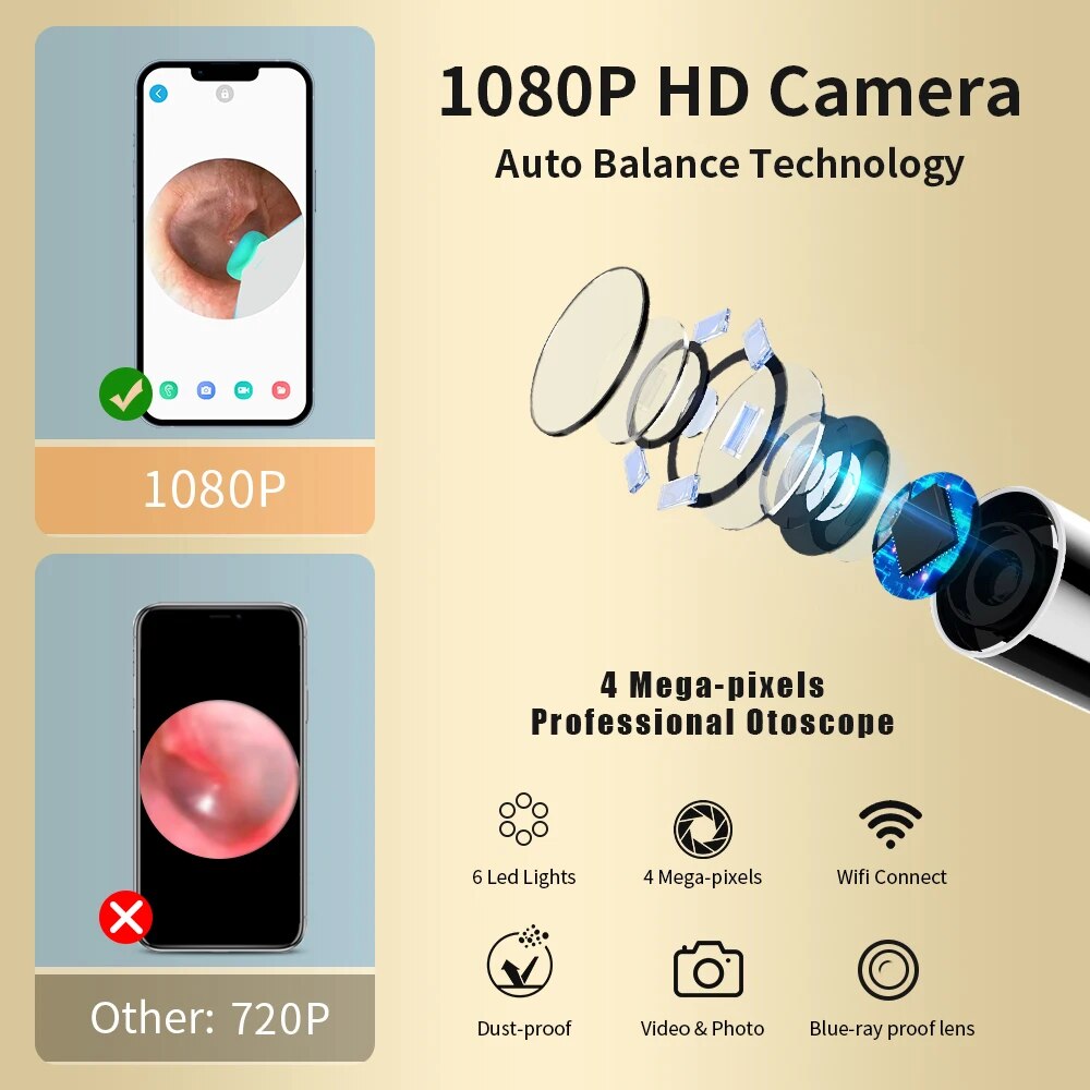 Nettoyeur d'oreilles avec caméra HD - Inspection en direct sur smartphone