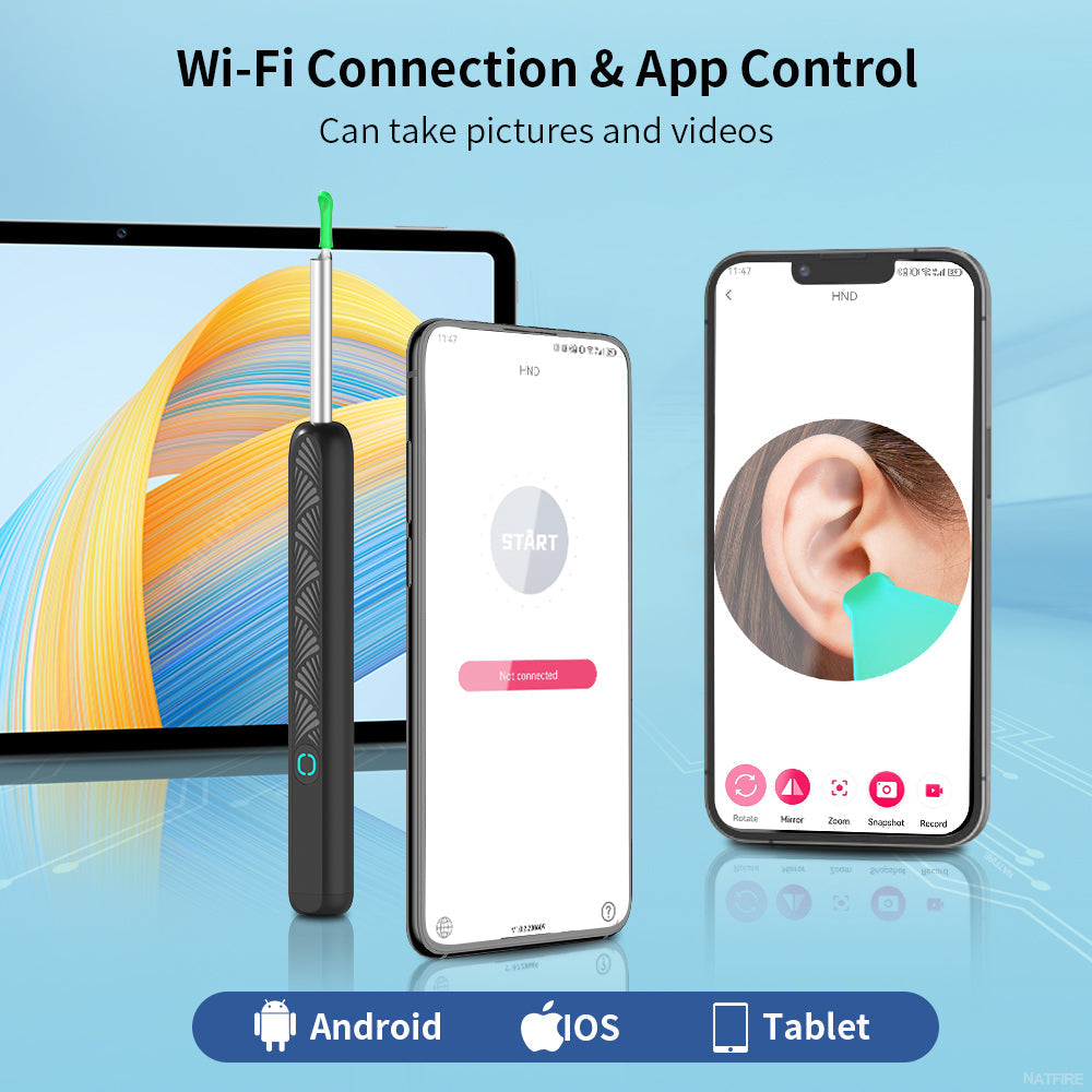 Nettoyeur d'oreilles avec caméra HD - Inspection en direct sur smartphone