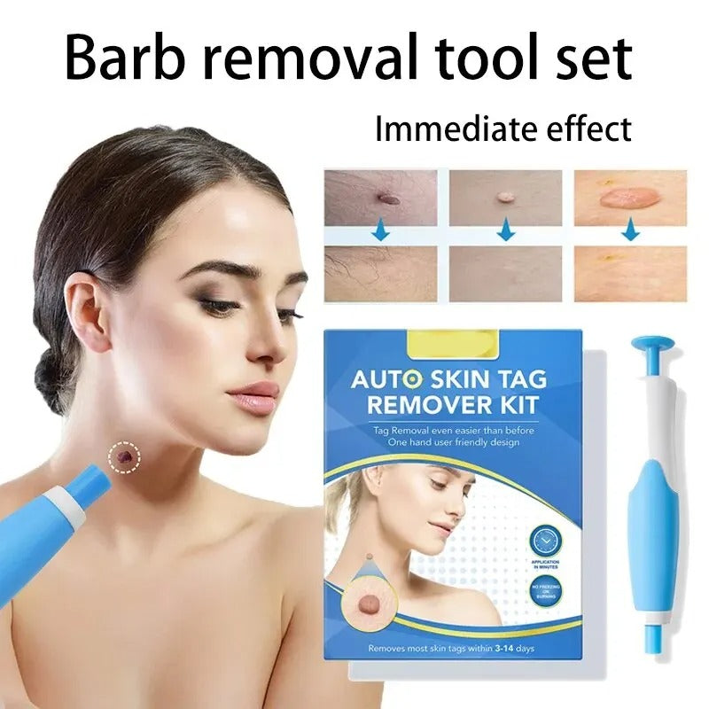 Kit per la rimozione dei fibromi penduli a casa — trattamento delicato e indolore