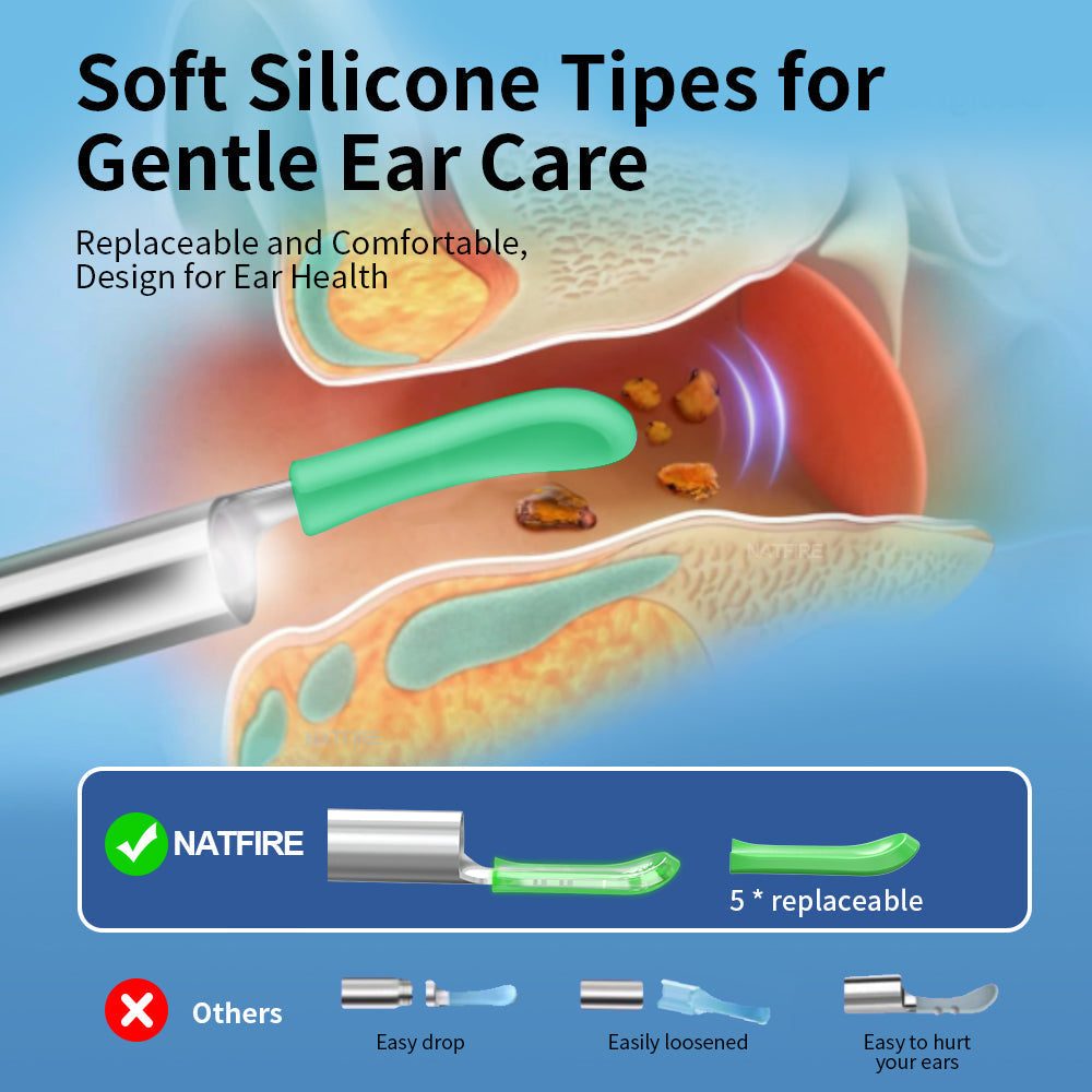 Nettoyeur d'oreilles avec caméra HD - Inspection en direct sur smartphone